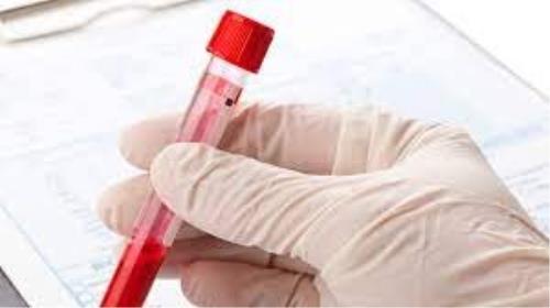 آغاز بزرگترین آزمایش جهانی تست خون برای تشخیص ۵۰ نوع سرطان
