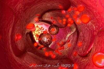 کشف نقش کلسترول در تغذیه متاستازهای سرطانی