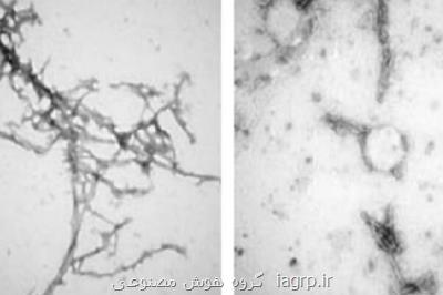 پاکسازی پروتئین های عامل بیماری پارکینسون با نانو بادی