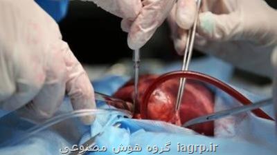 پژوهشگران گروه خونی کلیه پیوندی را تغییر دادند