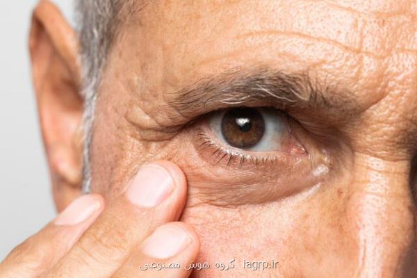 پروتئینی که راز کاهش بینایی در دوره پیری را فاش می کند