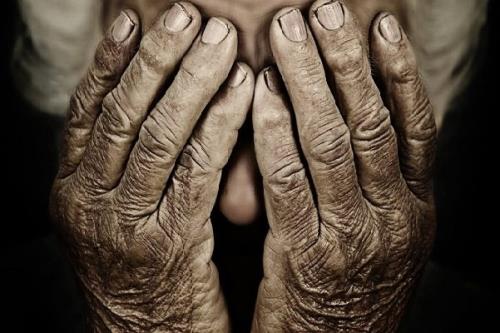 یافتن چاره ای از جانب پژوهشگران ایرانی برای مقابله با پیری پوست