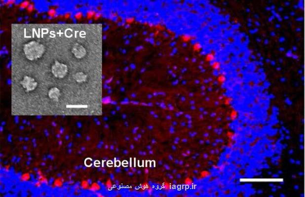 ابداع یك روش نوین برای عبور دارو از سدخونی مغز