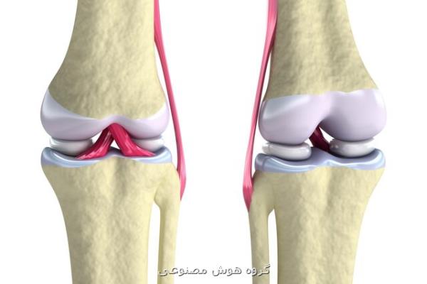 ترمیم غضروف زانو با جوهر زیستی و چاپ ۳ بعدی