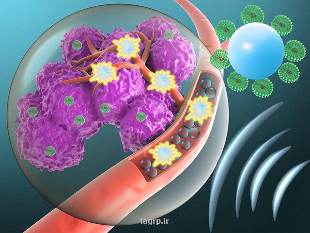 ارسال مستقیم داروها به تومور با كمك میكروحباب ها